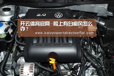开云体育官网-脸上有白癜风怎么办?(图2) 开云体育数据